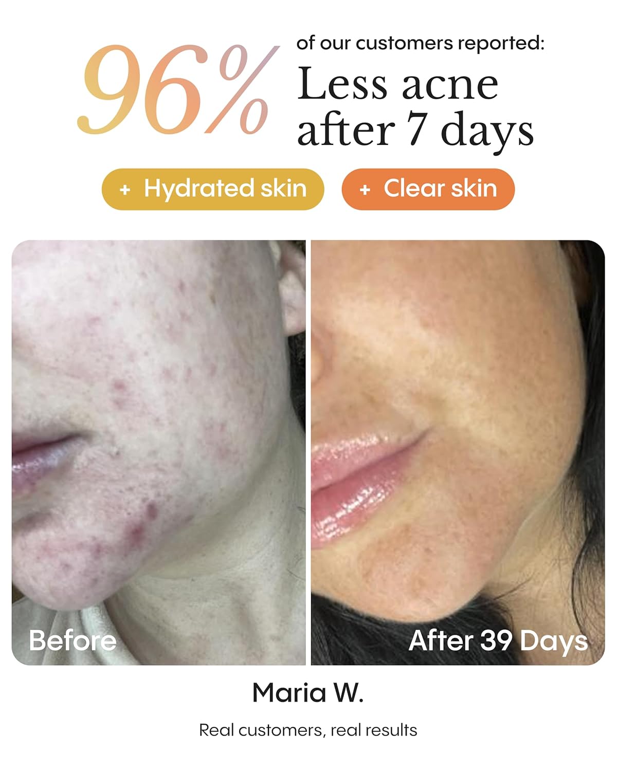 FRØYA Organics | Blemish Control & Redness Relief Balm | Helps Clear Breakouts & Restore Oil Balance | Calendula & Lavender Cleanse Pores | Reduce Facial Redness | Prevent Future Breakouts | 30ml - Image 6