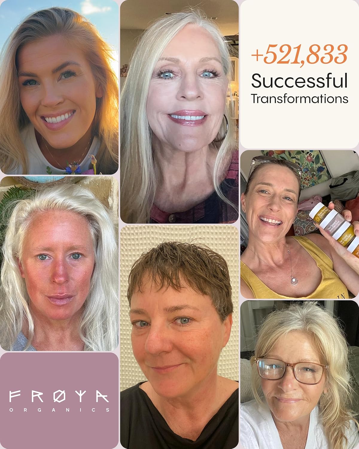 FRØYA Organics | Blemish Control & Redness Relief Balm | Helps Clear Breakouts & Restore Oil Balance | Calendula & Lavender Cleanse Pores | Reduce Facial Redness | Prevent Future Breakouts | 30ml - Image 9